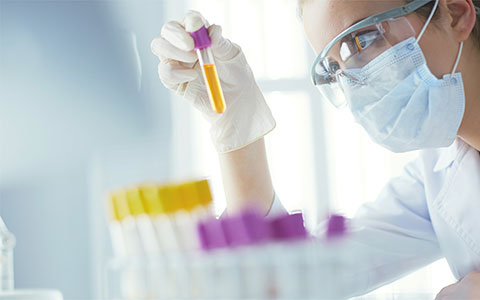 What is flow cytometry? The basics of flow cytometry and flow cytometers are explained. | Matsusada Precision