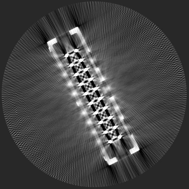 This photo is metal artifact.