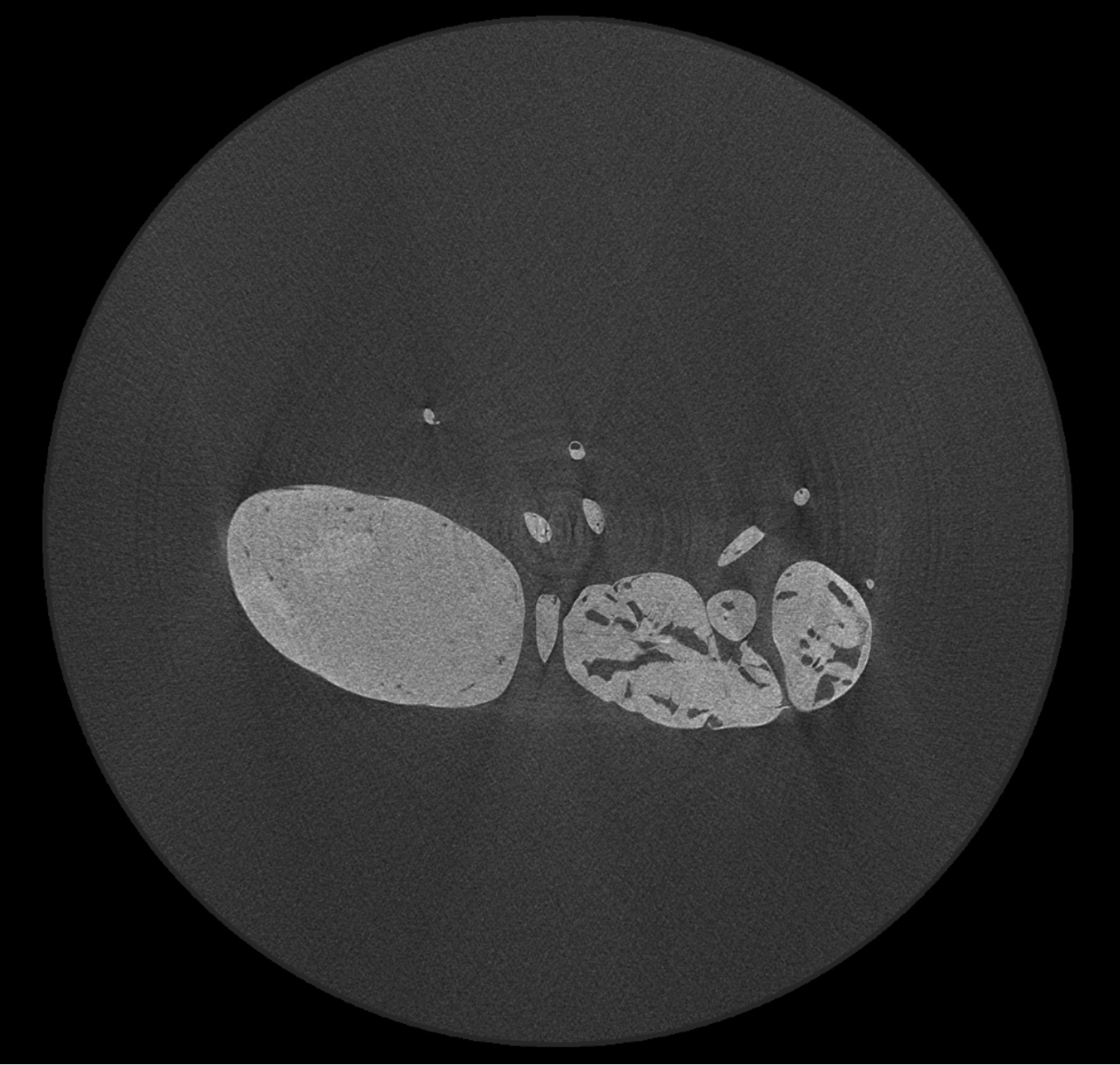 This photo is shower-like artifact.